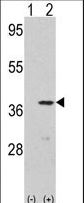 CDK3 Antibody - Western blot of CDK3(arrow) using rabbit polyclonal CDK3 Antibody (N-term Y19). 293 cell lysates (2 ug/lane) either nontransfected (Lane 1) or transiently transfected with the CDK3 gene (Lane 2) (Origene Technologies).