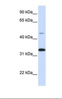 CDK3 Antibody - Hela cell lysate. Antibody concentration: 1.0 ug/ml. Gel concentration: 12%.  This image was taken for the unconjugated form of this product. Other forms have not been tested.