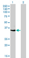 CDK3 Antibody - Western blot of CDK3 expression in transfected 293T cell line by CDK3 monoclonal antibody (M01), clone 3C12.