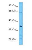 CDK3 Antibody - Western blot of CDK3 Antibody with human 293T Whole Cell lysate.  This image was taken for the unconjugated form of this product. Other forms have not been tested.