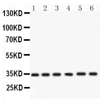 CDK4 Antibody - Cdk4 antibody Western blot. All lanes: Anti Cdk4 at 0.5 ug/ml. Lane 1: Rat Gaster Tissue Lysate at 50 ug. Lane 2: Rat Thymus Tissue Lysate at 50 ug. Lane 3: HELA Whole Cell Lysate at 40 ug. Lane 4: A549 Whole Cell Lysate at 40 ug. Lane 5: SKOV Whole Cell Lysate at 40 ug. Lane 6: 22RV1 Whole Cell Lysate at 40 ug. Predicted band size: 34 kD. Observed band size: 34 kD.