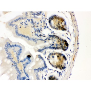 CDK4 Antibody - Cdk4 antibody IHC-paraffin. IHC(P): Mouse Intestine Tissue.
