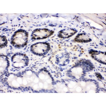CDK4 Antibody - Cdk4 antibody IHC-paraffin. IHC(P): Rat Intestine Tissue.