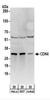 CDK4 Antibody - Detection of Human CDK4 by Western Blot. Samples: Whole cell lysate (50 ug) from HeLa, 293T, and Jurkat, cells. Antibodies: Affinity purified rabbit anti-CDK4 antibody used for WB at 0.1 ug/ml. Detection: Chemiluminescence with an exposure time of 30 seconds.