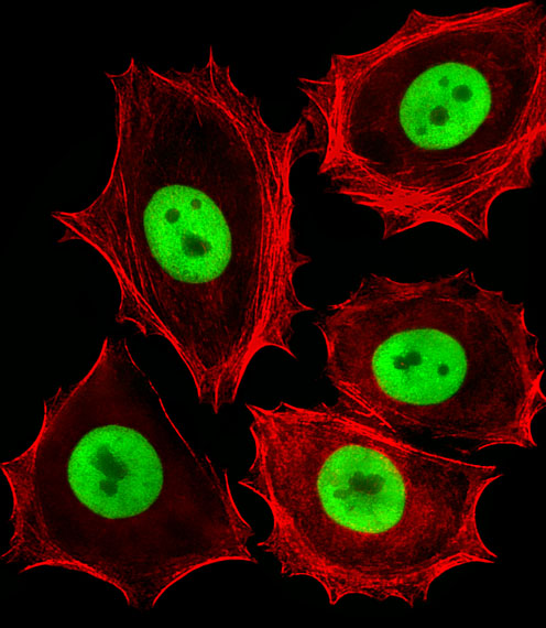 CDK4 Antibody - Fluorescent image of MCF-7 cells stained with (Rat) Cdk4 Antibody. Antibody was diluted at 1:25 dilution. An Alexa Fluor 488-conjugated goat anti-rabbit lgG at 1:400 dilution was used as the secondary antibody (green). Cytoplasmic actin was counterstained with Alexa Fluor 555 conjugated with Phalloidin (red).