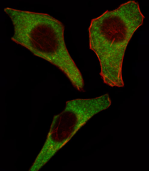 CDK4 Antibody - Fluorescent image of HeLa cell stained with CDK4 Antibody. HeLa cells were fixed with 4% PFA (20 min), permeabilized with Triton X-100 (0.1%, 10 min), then incubated with CDK4 primary antibody (1:25, 1 h at 37°C). For secondary antibody, Alexa Fluor 488 conjugated donkey anti-rabbit antibody (green) was used (1:400, 50 min at 37°C). Cytoplasmic actin was counterstained with Alexa Fluor 555 (red) conjugated Phalloidin (7units/ml, 1 h at 37°C). CDK4 immunoreactivity is localized to Cytoplasm significantly.