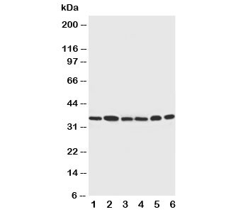 CDK4 Antibody - Western blot testing of Cdk4 antibody and Lane 1: rat thymus; 2: HeLa; 3: MCF-7; 4: A549; 5: COLO320; 6: Jurkat cell lysate