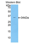 CDK4 Antibody - Western blot of recombinant CDK4.  This image was taken for the unconjugated form of this product. Other forms have not been tested.