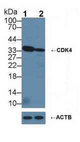 CDK4 Antibody - Knockout Varification: Lane 1: Wild-type Hela cell lysate; Lane 2: CDK4 knockout Hela cell lysate; Predicted MW: 33kDa ; Observed MW: 33kDa; Primary Ab: 1µg/ml Rabbit Anti-Human CDK4 Ab; Second Ab: 0.2µg/mL HRP-Linked Caprine Anti-Rabbit IgG Polyclonal Antibody;