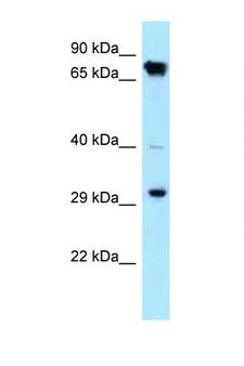 CDK4 Antibody - CDK4 antibody Western blot of HepG2 Cell lysate. Antibody concentration 1 ug/ml.  This image was taken for the unconjugated form of this product. Other forms have not been tested.