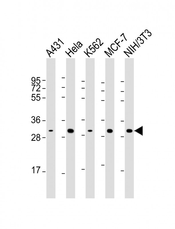 CDK4 Antibody - All lanes: Anti-CDK4 Antibody at 1:2000 dilution. Lane 1: A431 whole cell lysate. Lane 2: HeLa whole cell lysate. Lane 3: K562 whole cell lysate. Lane 4: MCF-7 whole cell lysate. Lane 5: NIH/3T3 whole cell lysate Lysates/proteins at 20 ug per lane. Secondary Goat Anti-mouse IgG, (H+L), Peroxidase conjugated at 1:10000 dilution. Predicted band size: 34 kDa. Blocking/Dilution buffer: 5% NFDM/TBST.