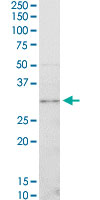 CDK4 Antibody - CDK4 monoclonal antibody (M03), clone 4F11. Western Blot analysis of CDK4 expression in HeLa NE.