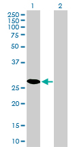 CDK4 Antibody - Western Blot analysis of CDK4 expression in transfected 293T cell line by CDK4 monoclonal antibody (M03), clone 4F11.Lane 1: CDK4 transfected lysate(33.7 KDa).Lane 2: Non-transfected lysate.