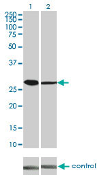 CDK4 Antibody - Western blot analysis of CDK4 over-expressed 293 cell line, cotransfected with CDK4 Validated Chimera RNAi (Lane 2) or non-transfected control (Lane 1). Blot probed with CDK4 monoclonal antibody (M03) clone 4F11 . GAPDH ( 36.1 kDa ) used as specificity and loading control.