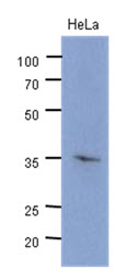 CDK4 Antibody - Western Blot: The cell lysate of HeLa (40 ug) were resolved by SDS-PAGE, transferred to PVDF membrane and probed with anti-human CDK4 antibody (1:500). Proteins were visualized using a goat anti-mouse secondary antibody conjugated to HRP and an ECL detection system.