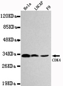 CDK4 Antibody - Western blot detection of CDK4 in Hela,LNCAP&F9 cell lysates using CDK4 antibody (1:1000 diluted).