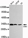 CDK4 Antibody - Western blot detection of CDK4 in Hela,LNCAP&F9 cell lysates using CDK4 antibody (1:1000 diluted).