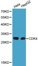 CDK4 Antibody - Western blot of CDK4 pAb in extracts from Hela and HepG2 cells.