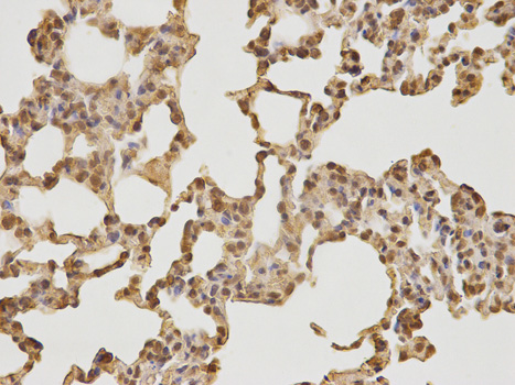 CDK4 Antibody - Immunohistochemistry of paraffin-embedded rat lung using CDK4 antibody at dilution of 1:100 (400x lens).