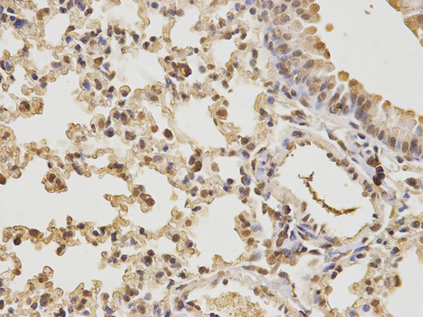 CDK4 Antibody - Immunohistochemistry of paraffin-embedded mouse lung using CDK4 antibody at dilution of 1:100 (400x lens).