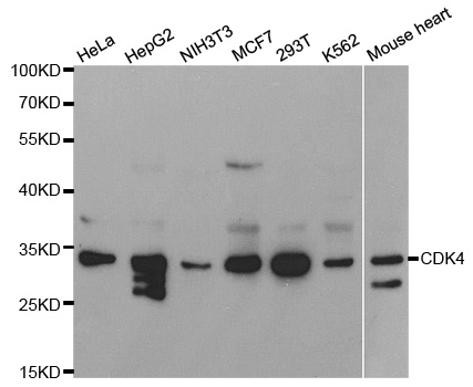 CDK4 Antibody - Western blot analysis of extracts of various cell lines, using CDK4 antibody at 1:1000 dilution. The secondary antibody used was an HRP Goat Anti-Rabbit IgG (H+L) at 1:10000 dilution. Lysates were loaded 25ug per lane and 3% nonfat dry milk in TBST was used for blocking.