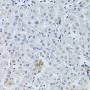CDK4 Antibody - Immunohistochemistry of paraffin-embedded mouse kidney using CDK4 Antibodyat dilution of 1:100 (40x lens).