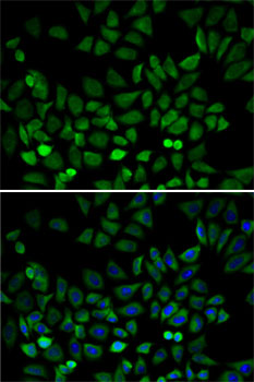 CDK4 Antibody - Immunofluorescence analysis of A-549 cells using CDK4 antibody. Blue: DAPI for nuclear staining.
