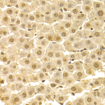 CDK4 Antibody - Immunohistochemistry of paraffin-embedded rat liver using CDK4 Antibodyat dilution of 1:100 (40x lens).
