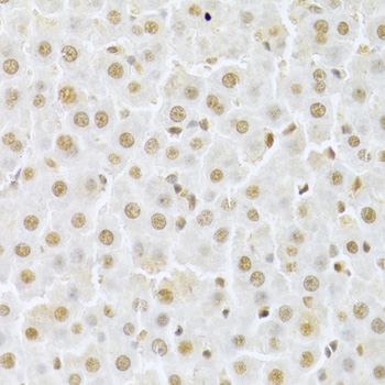 CDK4 Antibody - Immunohistochemistry of paraffin-embedded rat liver using CDK4 Antibodyat dilution of 1:100 (40x lens).