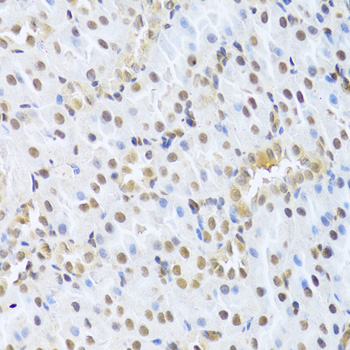CDK4 Antibody - Immunohistochemistry of paraffin-embedded rat kidney using CDK4 Antibodyat dilution of 1:100 (40x lens).