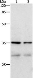 CDK4 Antibody - Western blot analysis of HeLa and 293T cell, using CDK4 Polyclonal Antibody at dilution of 1:450.
