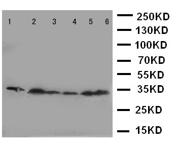 CDK4 Antibody - WB of CDK4 antibody. Lane 1: Rat Thymus Tissue Lysate. Lane 2: HELA Cell Lysate. Lane 3: MCF-7 Cell Lysate. Lane 4: A549 Cell Lysate. Lane 5: COLO320 Cell Lysate. Lane 6: JURKAT Cell Lysate.