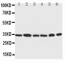 CDK4 Antibody - Anti-Cdk4 antibody, Western blotting Lane 1: Rat Thymus Tissue LysateLane 2: HELA Cell LysateLane 3: MCF-7 Cell LysateLane 4: A549 Cell LysateLane 5: COLO320 Cell LysateLane 6: JURKAT Cell Lysate