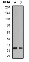 CDK4 Antibody - Western blot analysis of CDK4 expression in HepG2 (A); K562 (B) whole cell lysates.