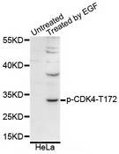 CDK4 Antibody - Western blot analysis of extracts of various cell lines.