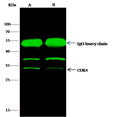 CDK4 Antibody - CDK4 was immunoprecipitated using: Lane A: 0.5 mg 293T Whole Cell Lysate. Lane B: 0.5 mg MCF-7 Whole Cell Lysate. 4 uL anti-CDK4 rabbit polyclonal antibody and 15 ul of 50% Protein G agarose. Primary antibody: Anti-CDK4 rabbit polyclonal antibody, at 1:100 dilution. Secondary antibody: Dylight 800-labeled antibody to rabbit IgG (H+L), at 1:5000 dilution. Developed using the odssey technique. Performed under reducing conditions. Predicted band size: 34 kDa. Observed band size: 34 kDa.