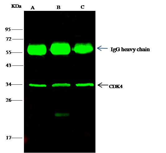 CDK4 Antibody - CDK4 was immunoprecipitated using: Lane A: 0.5 mg HepG2 Whole Cell Lysate. Lane B: 0.5 mg k562 Whole Cell Lysate. Lane C:0.5 mg Hela Whole Cell Lysate. 2 uL anti-CDK4 rabbit polyclonal antibody and 15 ul of 50% Protein G agarose. Primary antibody: Anti-CDK4 rabbit polyclonal antibody, at 1:100 dilution. Secondary antibody: Dylight 800-labeled antibody to rabbit IgG (H+L), at 1:5000 dilution. Developed using the odssey technique. Performed under reducing conditions. Predicted band size: 34 kDa. Observed band size: 34 kDa.