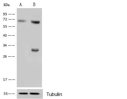 CDK4 Antibody - Anti-CDK4 rabbit polyclonal antibody at 1:500 dilution. Lane A: CDK4 konckout Hela Whole Cell Lysate. Lane B: Hela Whole Cell Lysate. Lysates/proteins at 10 ug per lane. Secondary: Goat Anti-Rabbit IgG H&L (Dylight 800) at 1/10000 dilution. Developed using the ECL technique. Performed under reducing conditions. Predicted band size: 34 kDa. Observed band size: 33 kDa. (We are unsure as to the identity of these extra bands.)