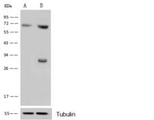 CDK4 Antibody - Anti-CDK4 rabbit polyclonal antibody at 1:500 dilution. Lane A: CDK4 konckout Hela Whole Cell Lysate. Lane B: Hela Whole Cell Lysate. Lysates/proteins at 10 ug per lane. Secondary: Goat Anti-Rabbit IgG H&L (Dylight 800) at 1/10000 dilution. Developed using the ECL technique. Performed under reducing conditions. Predicted band size: 34 kDa. Observed band size: 33 kDa. (We are unsure as to the identity of these extra bands.)