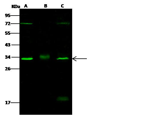 CDK4 Antibody - Anti-CDK4 rabbit polyclonal antibody at 1:500 dilution. Lane A: Hela Whole Cell Lysate. Lane B: MCF7 Whole Cell Lysate. Lane C: K562 Whole Cell Lysate. Lysates/proteins at 30 ug per lane. Secondary: Goat Anti-Rabbit IgG H&L (Dylight 800) at 1/10000 dilution. Developed using the Odyssey technique. Performed under reducing conditions. Predicted band size: 34 kDa. Observed band size: 33 kDa. (We are unsure as to the identity of these extra bands.)