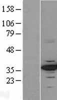 CDK4 Protein - Western validation with an anti-DDK antibody * L: Control HEK293 lysate R: Over-expression lysate