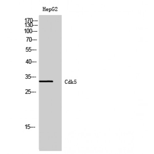 CDK5 Antibody - Western blot of Cdk5 antibody