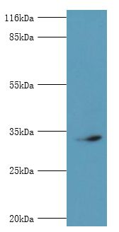 CDK5 Antibody - Western blot. All lanes:Cyclin-dependent kinase 5 antibody at 2 ug/ml+mouse brain tissue. Secondary antibody: goat polyclonal to rabbit at 1:10000 dilution. Predicted band size: 33 kDa. Observed band size: 33 kDa.  This image was taken for the unconjugated form of this product. Other forms have not been tested.