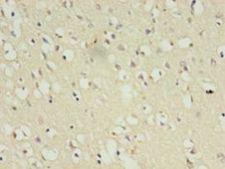 CDK5 Antibody - Immunohistochemistry of paraffin-embedded human brain tissue using antibody at 1:100 dilution.  This image was taken for the unconjugated form of this product. Other forms have not been tested.