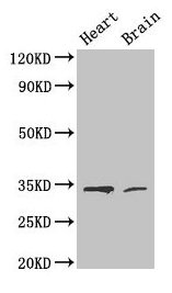 CDK5 Antibody - Western Blot Positive WB detected in: Mouse heart, Mouse brain All lanes: CDK5 antibody at 4µg/ml Secondary Goat polyclonal to rabbit IgG at 1/50000 dilution Predicted band size: 34, 30 kDa Observed band size: 34 kDa