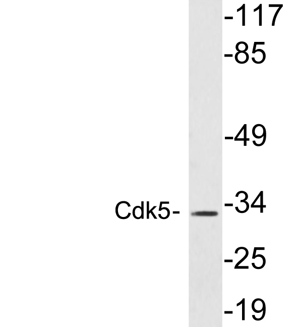 CDK5 Antibody - Western blot analysis of lysates from HT29 cells, using Cdk5 antibody.
