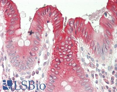 CDK5 Antibody - Human Colon: Formalin-Fixed, Paraffin-Embedded (FFPE).  This image was taken for the unconjugated form of this product. Other forms have not been tested.