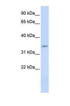 CDK5 Antibody - CDK5 antibody western blot of 721_B Cell lysate. Antibody concentration 1 ug/ml.  This image was taken for the unconjugated form of this product. Other forms have not been tested.