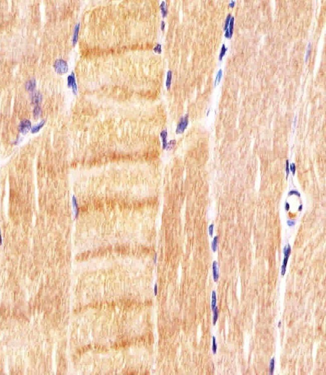 CDK5 Antibody - Antibody staining CDK5 in human skeletal muscle sections by Immunohistochemistry (IHC-P - paraformaldehyde-fixed, paraffin-embedded sections). Tissue was fixed with formaldehyde and blocked with 3% BSA for 0. 5 hour at room temperature; antigen retrieval was by heat mediation with a citrate buffer (pH 6). Samples were incubated with primary antibody (1:25) for 1 hours at 37°C. A undiluted biotinylated goat polyvalent antibody was used as the secondary antibody.