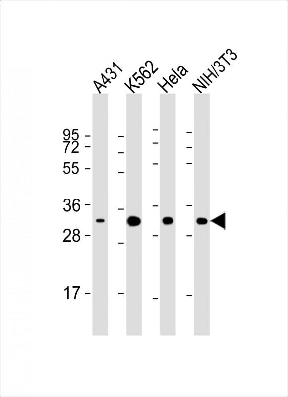 CDK5 Antibody - All lanes: Anti-CDK5 Antibody at 1:2000 dilution. Lane 1: A431 whole cell lysate. Lane 2: K562 whole cell lysate. Lane 3: HeLa whole cell lysate. Lane 4: NIH/3T3 whole cell lysate Lysates/proteins at 20 ug per lane. Secondary Goat Anti-mouse IgG, (H+L), Peroxidase conjugated at 1:10000 dilution. Predicted band size: 33 kDa. Blocking/Dilution buffer: 5% NFDM/TBST.